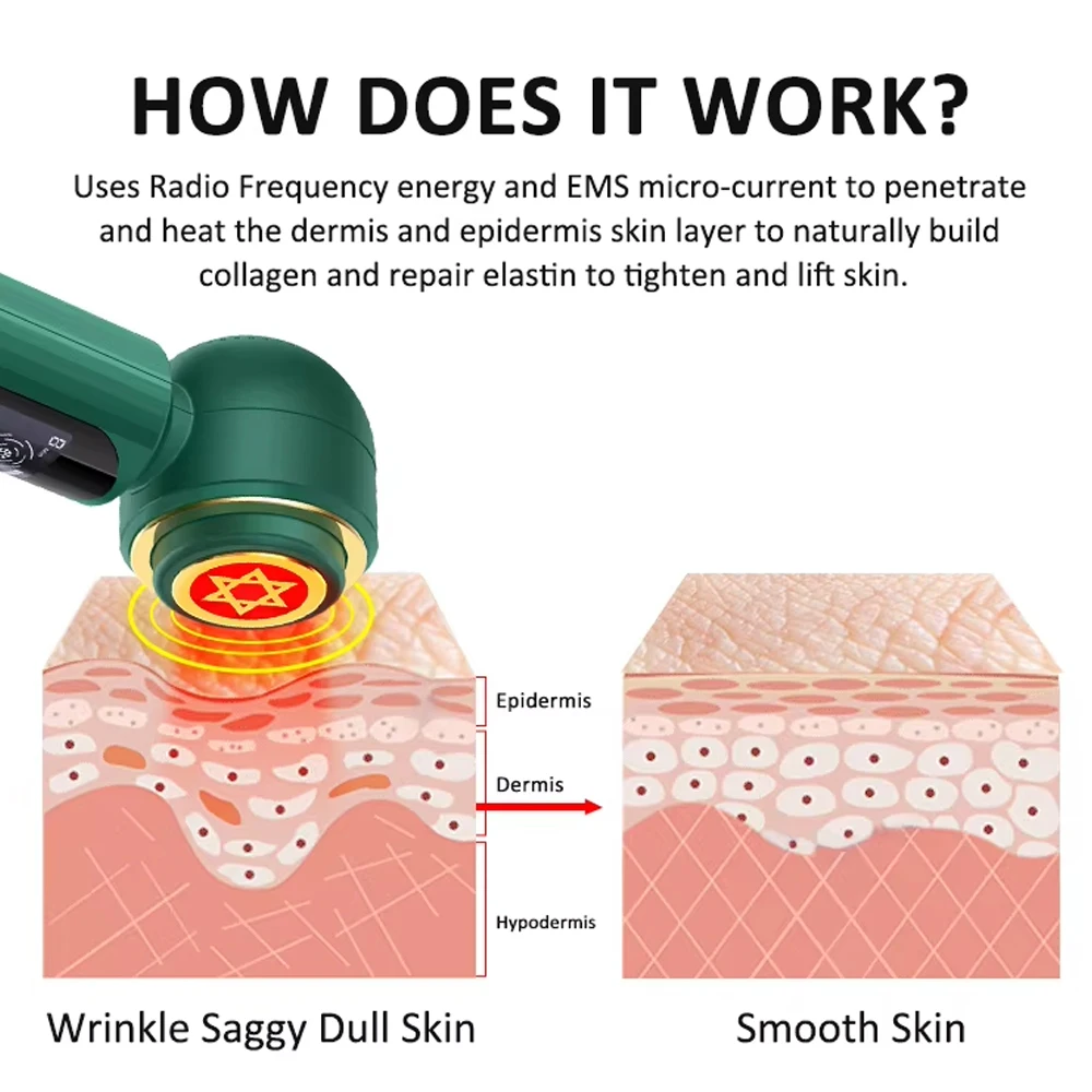 Dispositivo facciale a microcorrente EMS Massaggiatore facciale antietà RF Dispositivo per il lifting del viso Terapia della luce a LED Martello di ghiaccio Ringiovanimento della pelle