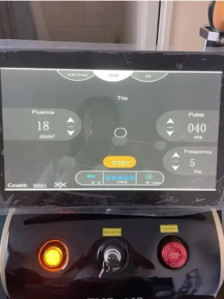 سوبرانو تيتانيوم إزالة الشعر المهنية 4 في 1 ديود ليزر بيكو Ipl Nd Yag بيكو ثانية ليزر Opt إزالة الشعر إزالة الوشم #1