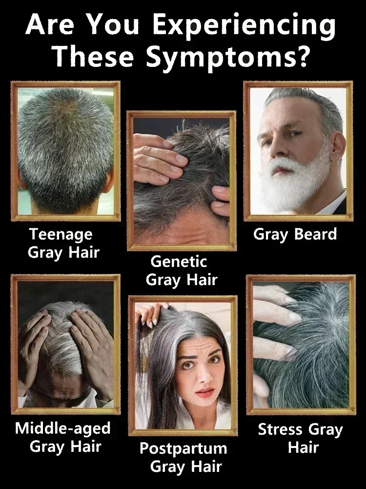 1ST NEW White To Black Gray White Hair Serum Natural Color Repair Nourish Essence Anti-gray Care for Men Women