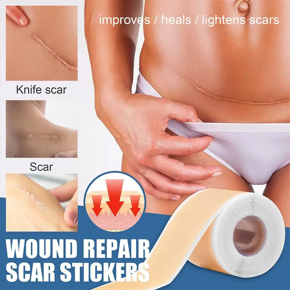 Silicone Surgical Scar Removal Patch Remove Trauma Burn Sheet Skin Repair Scar Removal Therapy Patch For Acne Scar Treatment