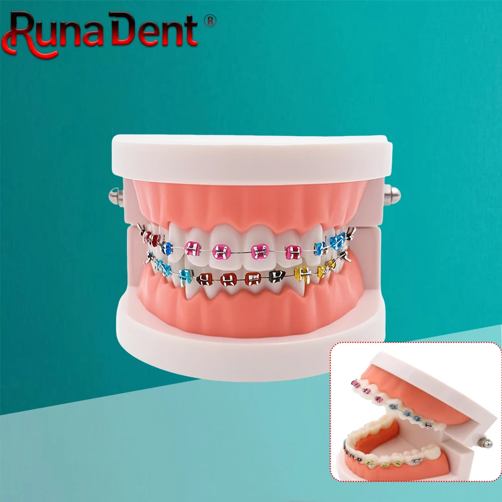 

Dental Orthodontic Treatment Model Ortho Metal Brackets Arch Wires Buccal Tubes Ligature Ties Orthodontics Training Kit