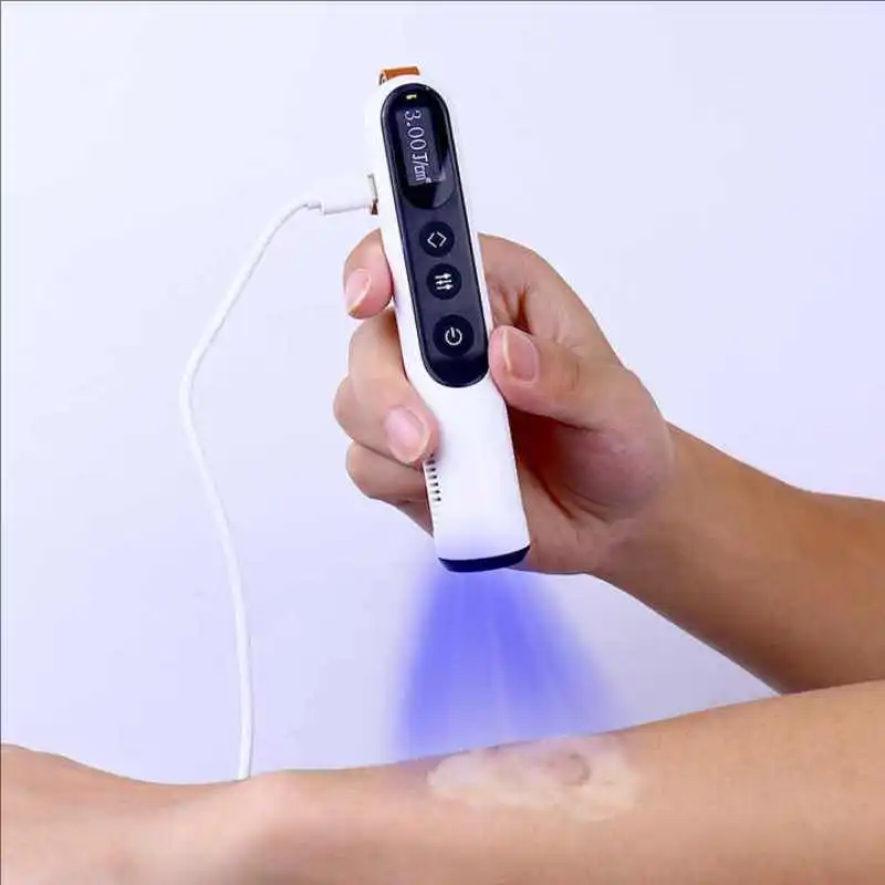 308nm Excimer Laser Light Therapy Machine 10mW/cm² High Intensity UVB Phototherapy Lamp for Vitiligo Psoriasis Treatment