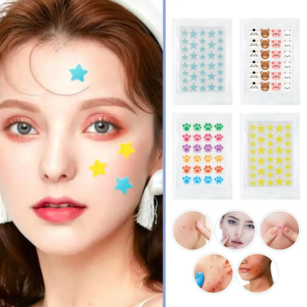 Hydrokoloidowe plastry na trądzik z motywem zwierząt z kreskówek, niewidoczne, usuwające wypryski, wodoodporne, korektor do przebarwień, naprawcze naklejki, pielęgnacja skóry.