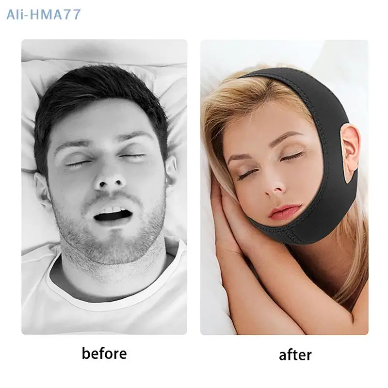 Adjustable New Neoprene Anti Snoring Strap Stop Chin Mouth Guard Treatment Snore Relieve for Sleep