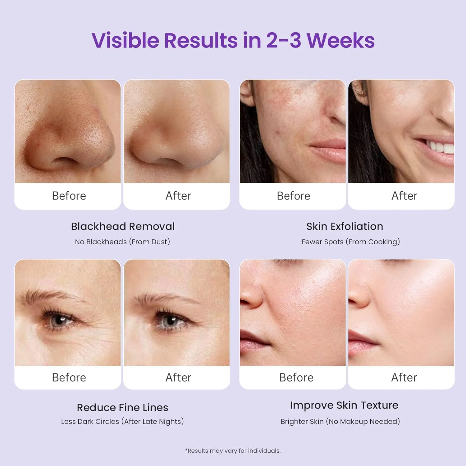 Trinity diamond micro-carving instrument micro-crystalline skin polishing head spray moisturize absorb blackheads pore cleaning
