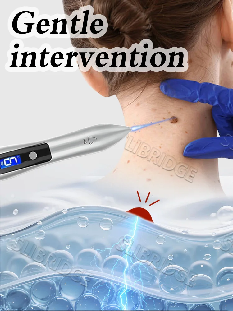 Blue Light Pen Solve Wart Tool