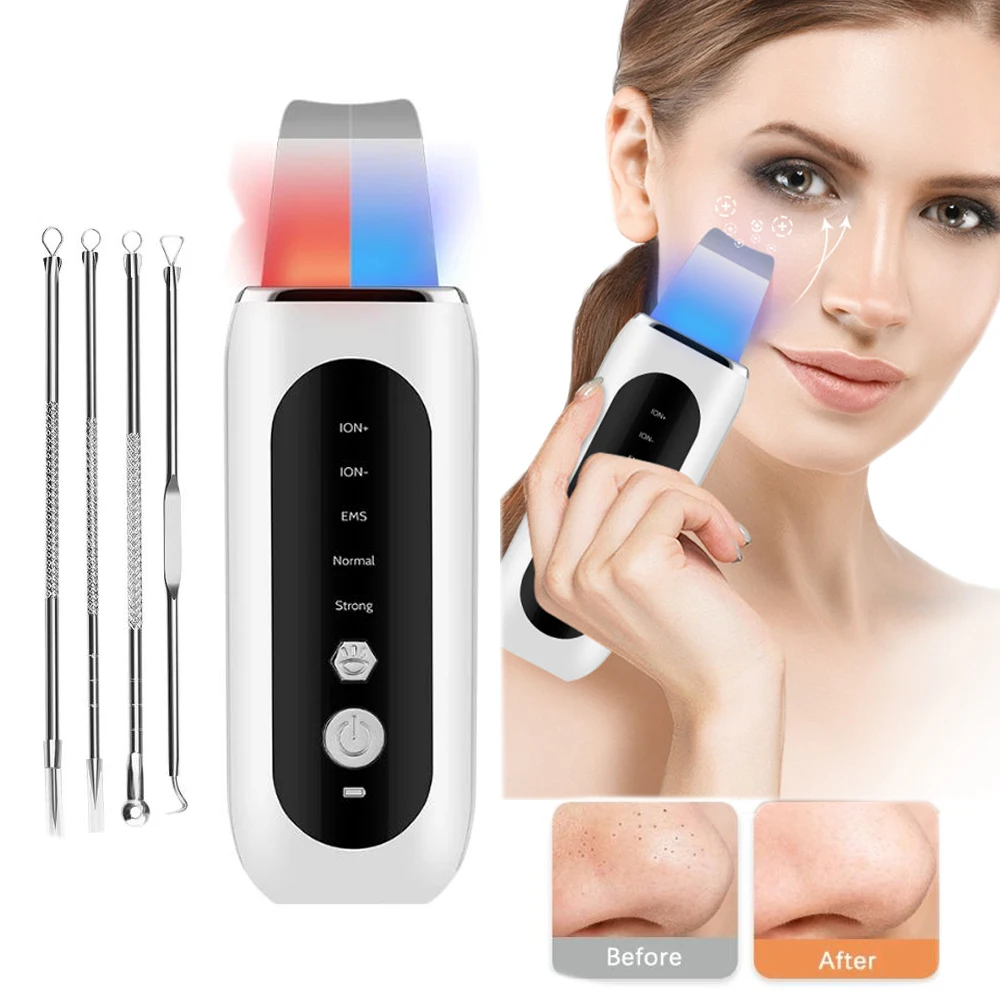 Electric Skin Scraping Machine with Micro Current for Removing Blackhead Keratin and Cleaning Pores Importing Beauty Equipment