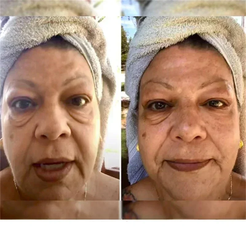 O creme anti-enrugamento do olho do Retinol, remove os sacos do olho, círculos escuros, levantamento, firmando, clareamento, hidratando, ilumina, cuidados com a pele