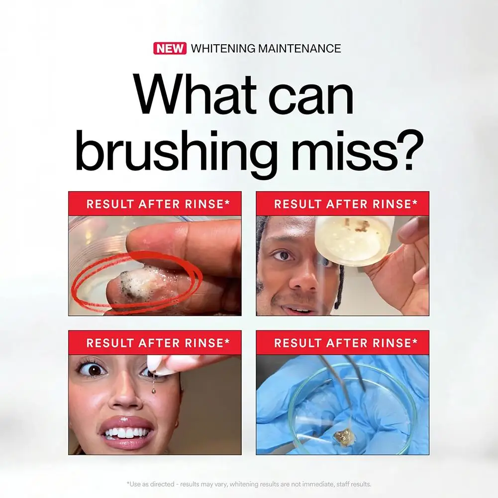 Thumbnail 4 - #40 Latest Teeth Whitening Offers