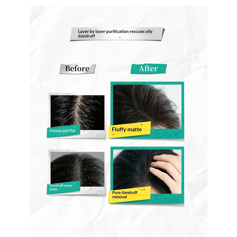 Nature's Envy Tea Tree Shampoo 390ml Oil Control Anti-Dandruff for Oily Scalp Refreshing Volumizing Plant Extracts