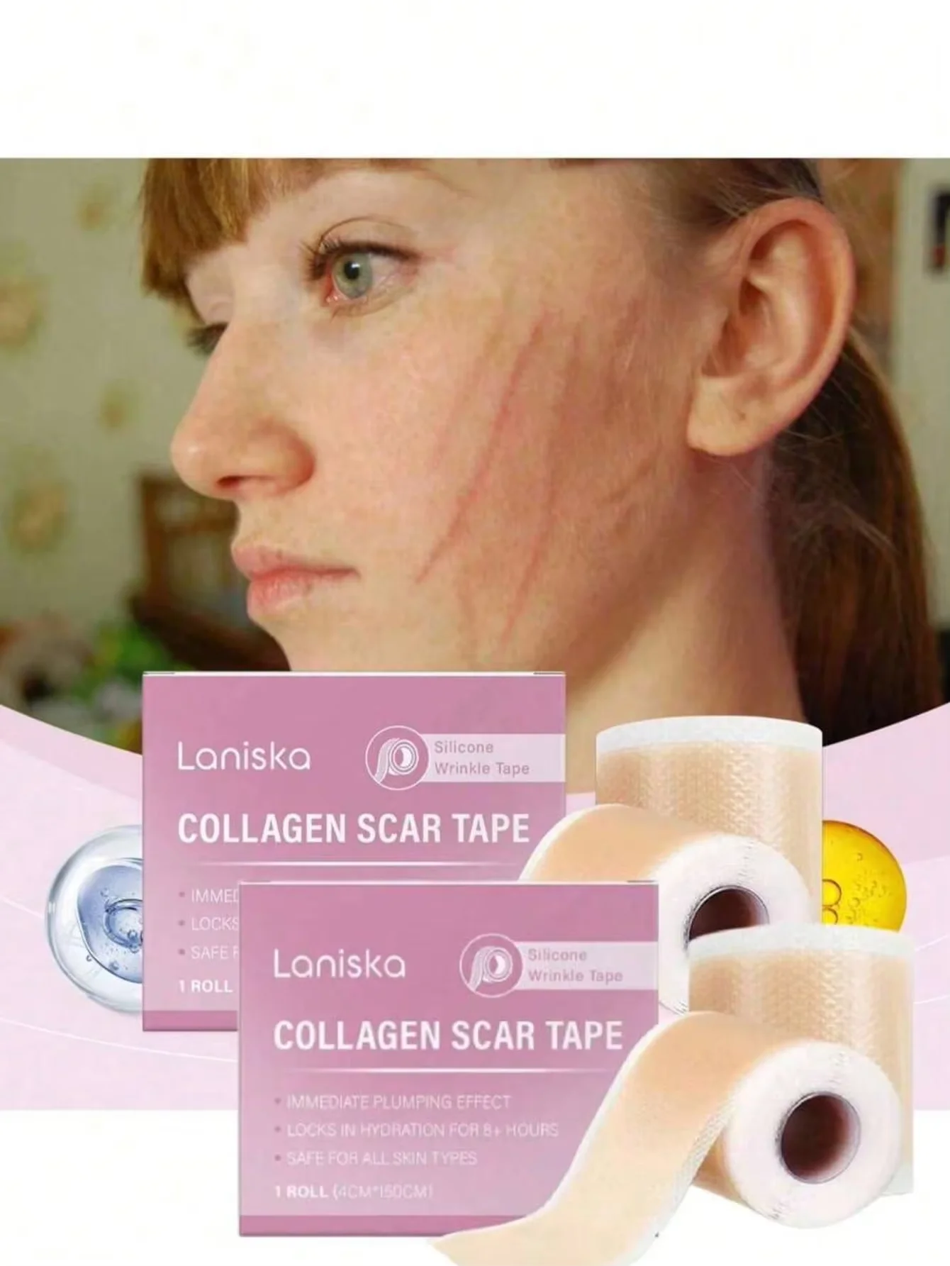 150cm Silicone Scar Patches with PET/PU Film, Transparent Self-Adhesive Sheets for Day and Night Scar Concealing