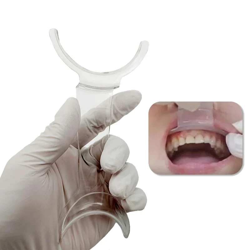 Dental Mouth Expand Lip Retractor Intraoral Cheek Upper Lower Lip Retractor Dental Mouths Openers Orthodontic Dentist Tools
