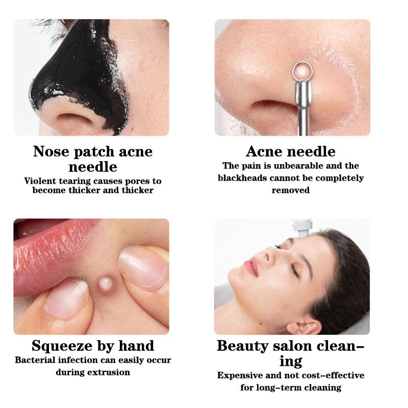 Mini pelle manuelle en acier inoxydable pour livres de pores, outil de nettoyage du visage pour enlever les points noirs et les boutons, levage et raffermissement