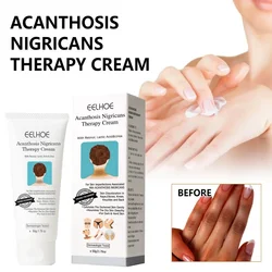 Armpit whitening cream for dark skin Underarm Bleaching Elbow Knee repair Groin Private Parts Brighten Spots Remove Melanin care