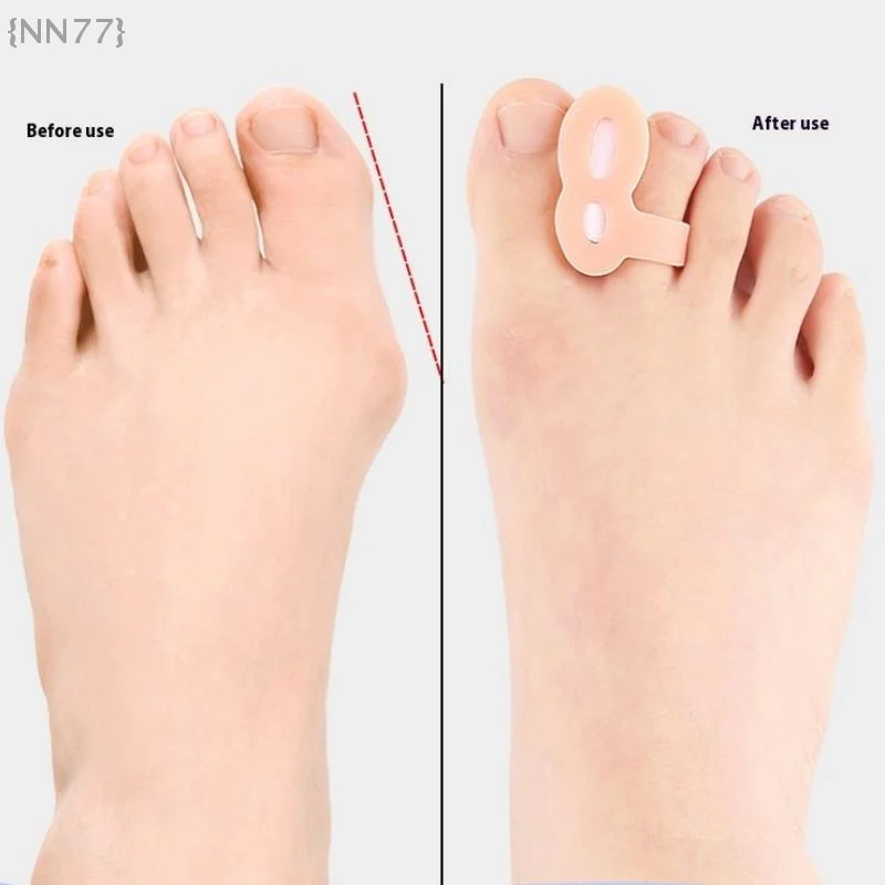 1 Pair Gel Toe Separator - Bunion Corrector & Toe Protector, Relieves Pain From Overlapping/Drifted Toe {NN77}