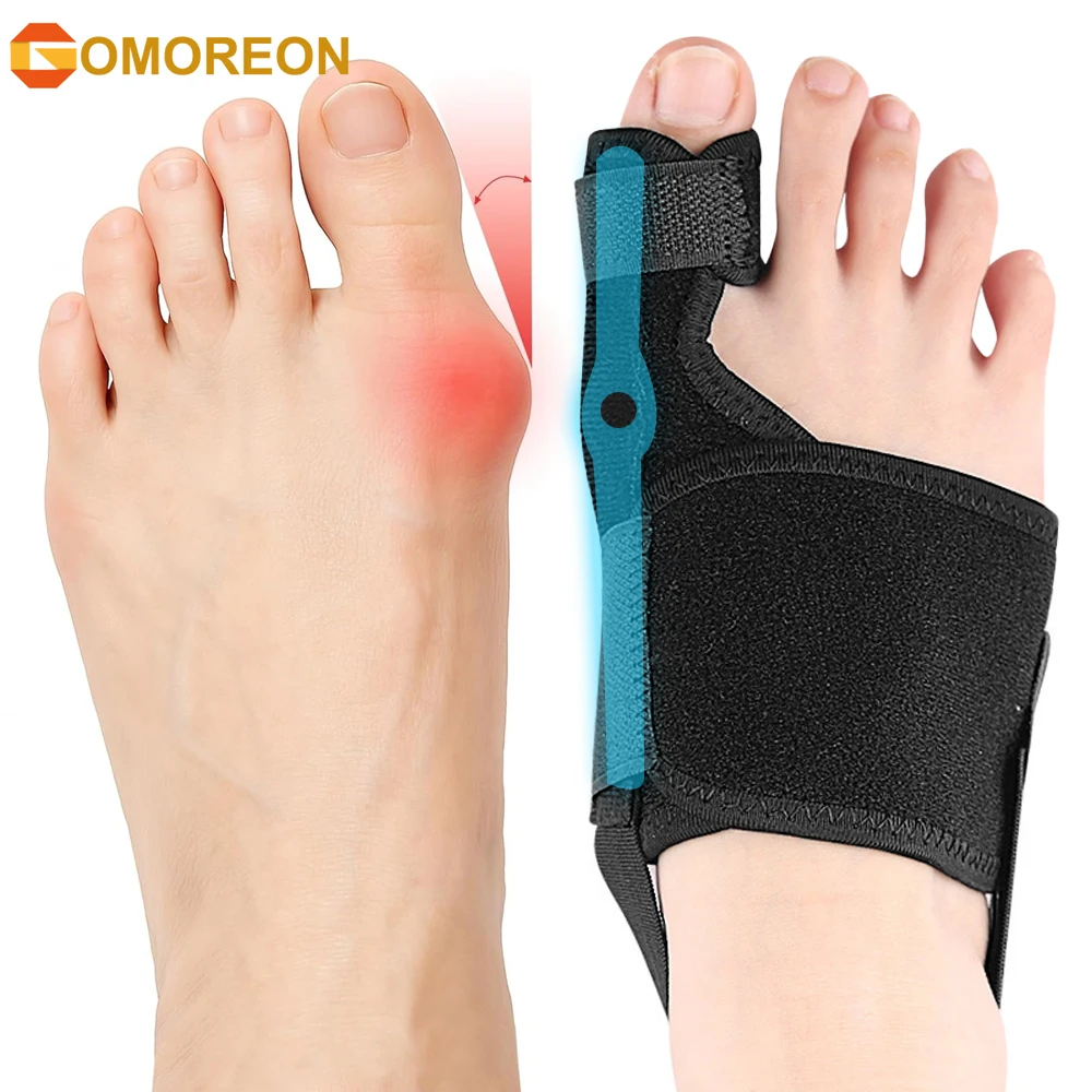 1PCS Bunion Corrector for Women Men Big Toe Straightener, Adjustable Bunion Splint Hallux Valgus Correction for Day and Night