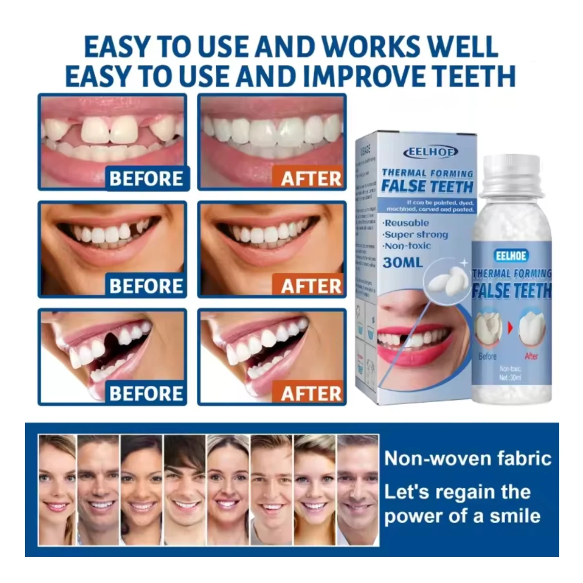 เรซิ่น 10 กรัม/20 กรัม/50 กรัม/1/2/4 ขวด สำหรับซ่อมฟันชั่วคราว ปิดช่องว่างฟัน ติดง่าย - เรซิ่นอุดฟัน - ทนทานและนำกลับมาใช้ใหม่ได้