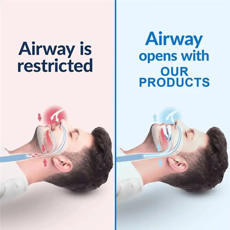 AEE4-Adjustable Anti Snoring Mouth Guard Braces Sleeping Anti-Snoring Devices Bruxisms Snoring Stopper Improve Sleep Snore