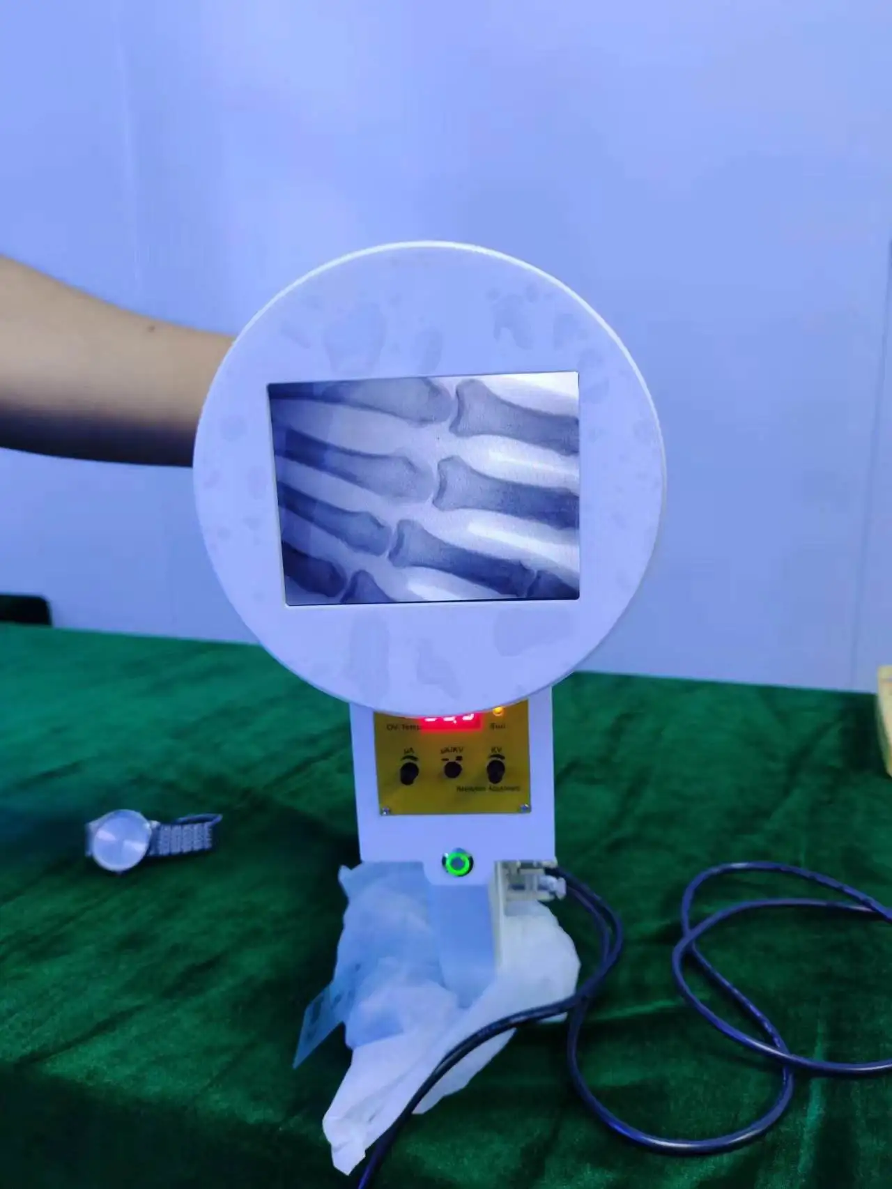 Orthopedics Radiology Radiologico Appearance Medical Fluoroscopy Veterinarian Portable X C Ray Fluoroscopio Equipo Machine