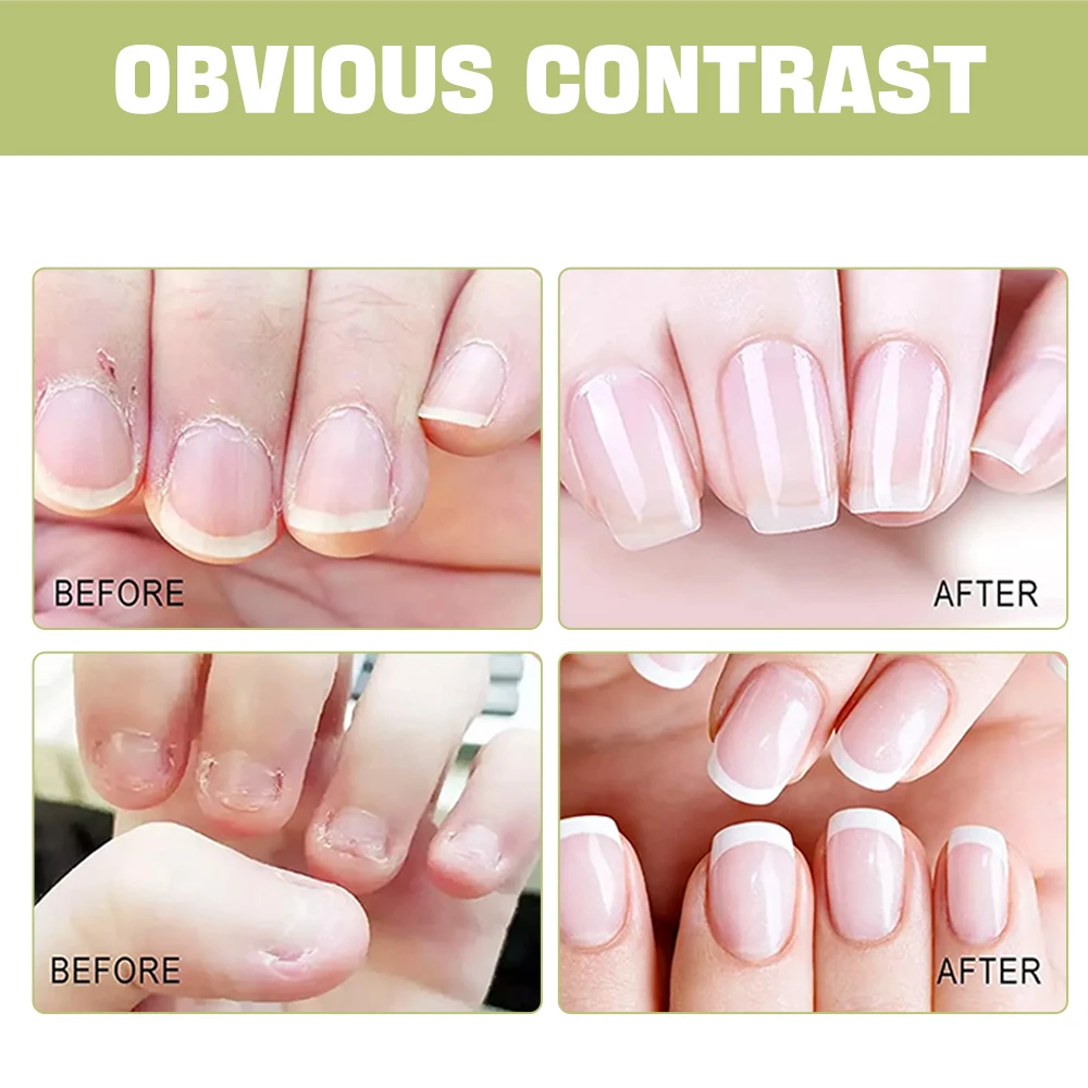 EJW Cuticle Oil Care – Nourishes & Protects Nails and Cuticles – Supports Healthy Toenails, Strength & Appearance.