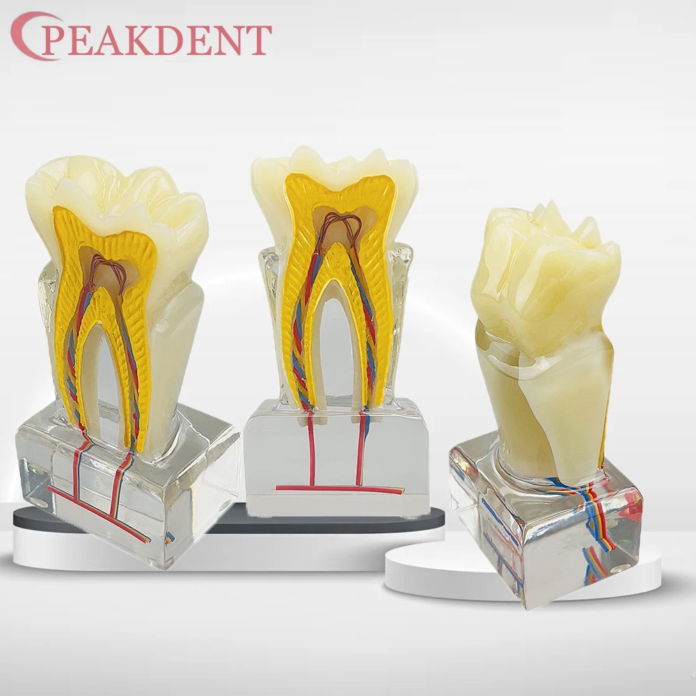 

Анатомия зубов, стоматологическая модель, обучающее исследование, стоматологическая анатомическая модель для демонстрации анатомического пределения базового нерва