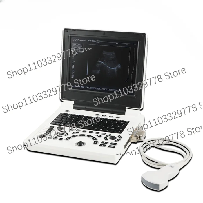 Cheap Laptop Black and White Ultrasound cheaper than logiq ultrasound 2D machine