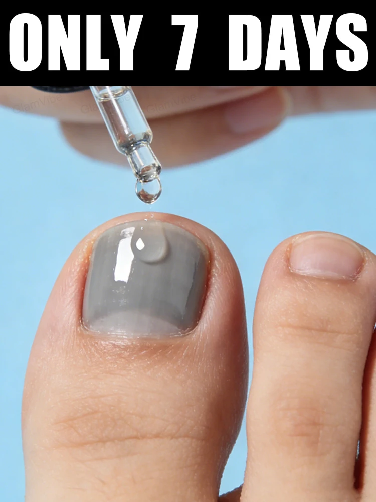 

Great news! Free shipping in 2026! Nail care solution, 10ml