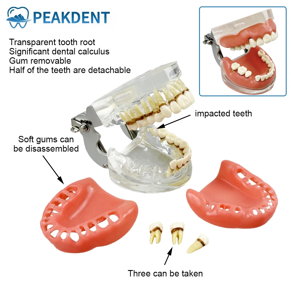 

Учебная модель зубов, патологические зубы, модель Typodont, заболевания пародонта, Pathologica, обучение, образование пациентов