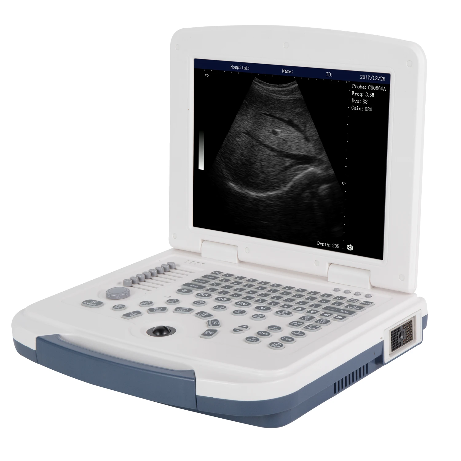 RC-BW580 The basic Black and White Portable ultra sound machine for sale