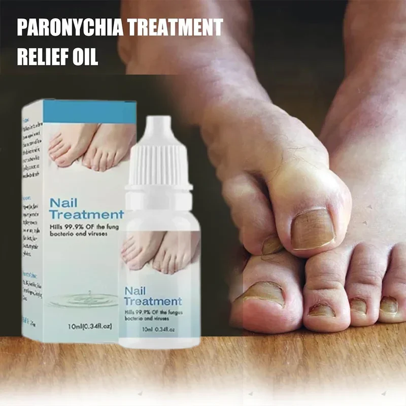 Fungal Nail Treatment Oil Foot Repair Essence Toe Nail Fungus Removal Gel Anti Infection Cream Fungal Nail Removal