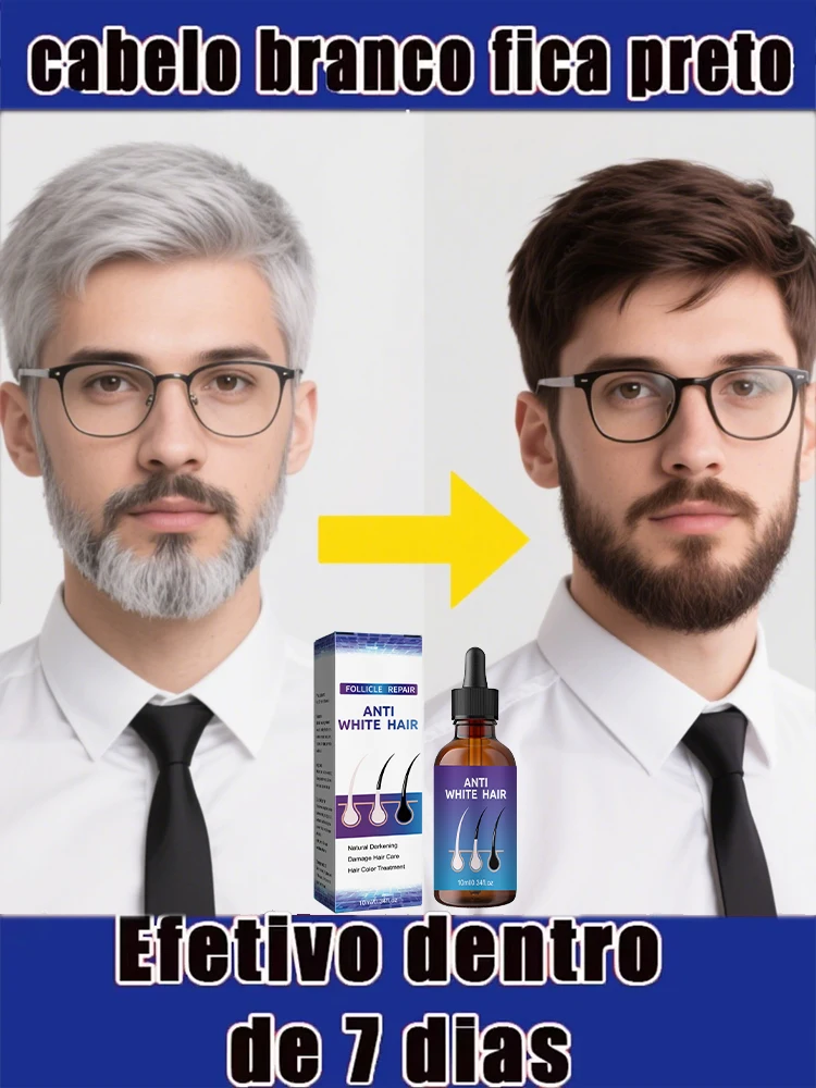 

White hair killer, remove gray hair and restore natural hair color in 7 days 4s