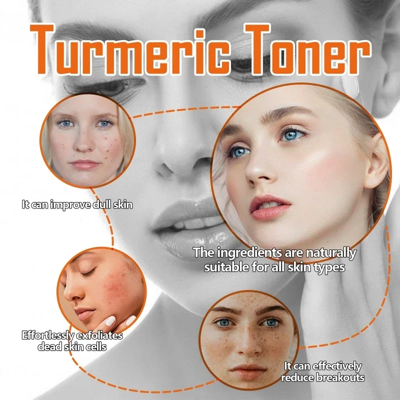 Tóner que ilumina la piel, elimina las pecas, aclara el Melasma, pigmentación, desvanece las manchas oscuras, hidratante, tóner facial de cúrcuma