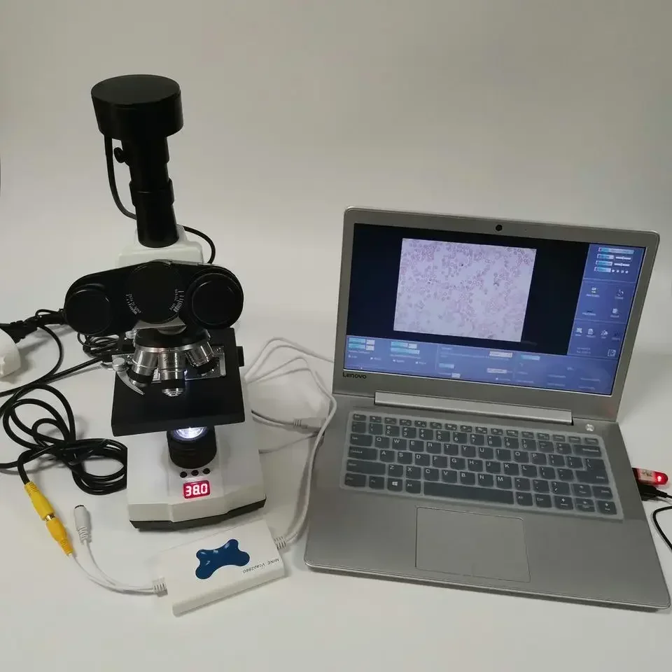

Hospital Lab Portable Automatic Sperm Test Equipment Laptop Sperm Count Quality Analyzer Microscope PLS-MY-B041A-3