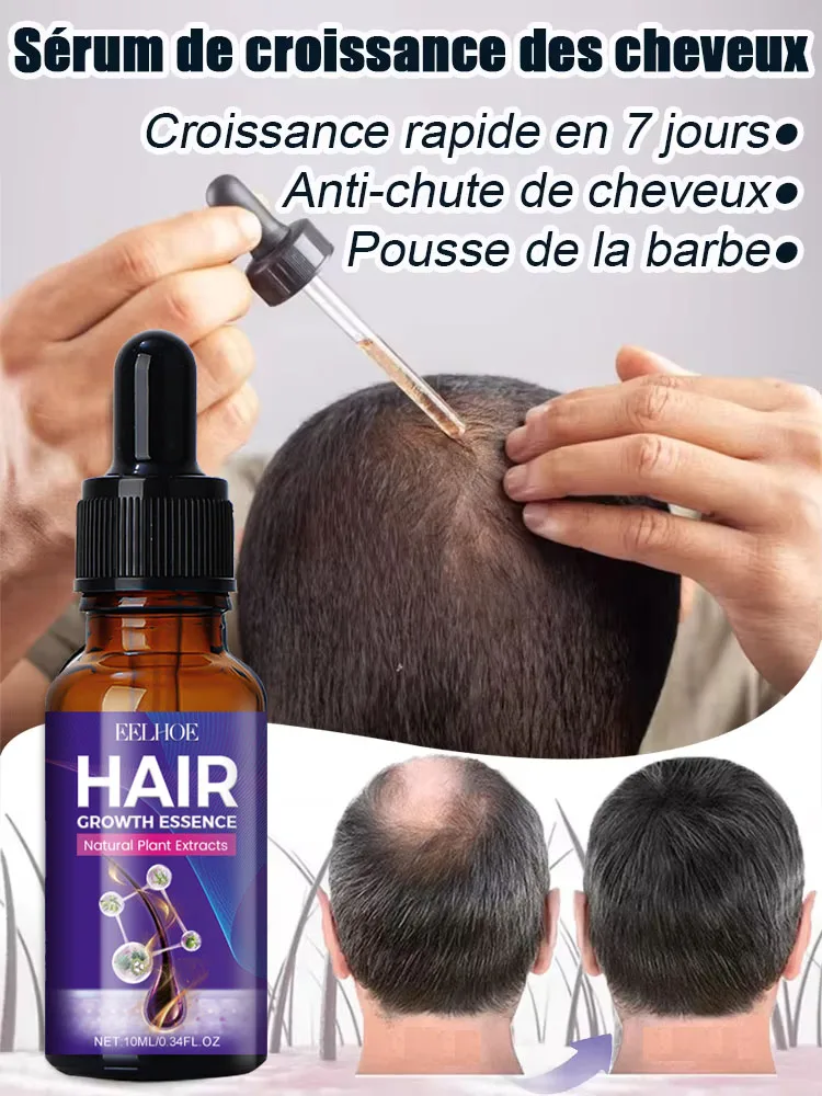 

Hot sale, buyers will buy again, hair is getting more and more, say goodbye to baldness, sparse hair starts to become thick