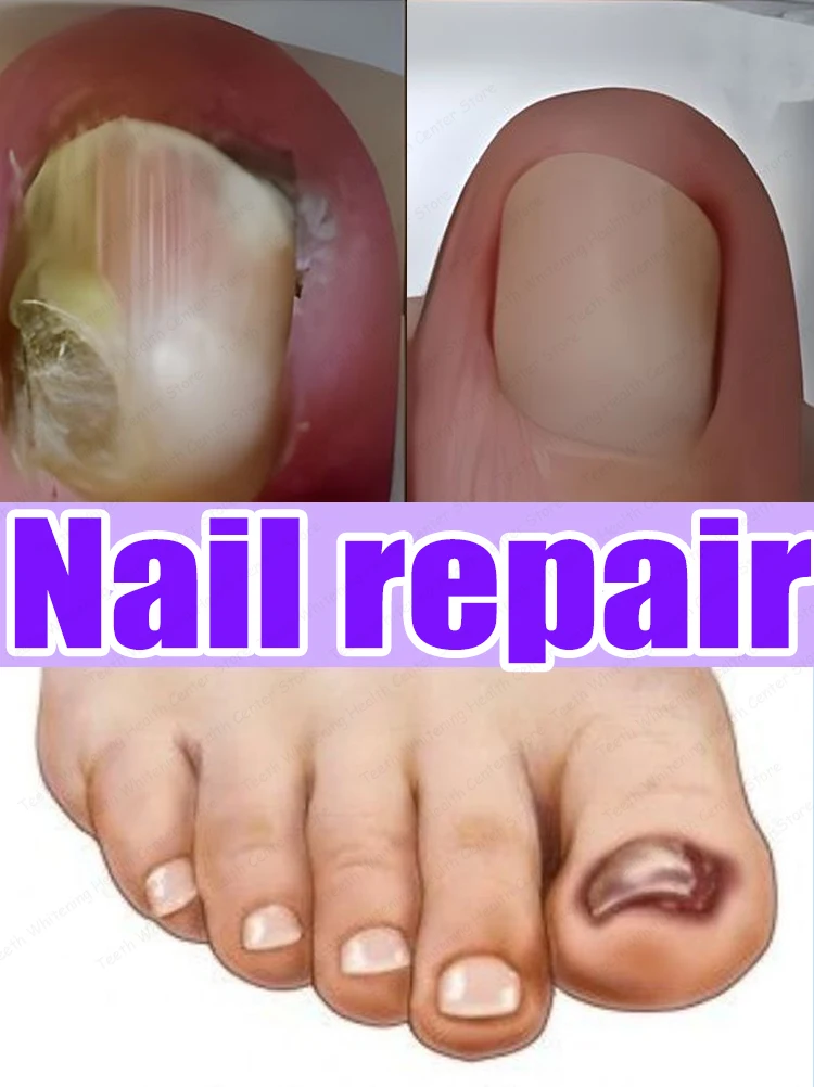 

Nail cleaning tools,ˢᵃʸ ᵍᵒᵒᵈᵇʸᵉ ᵗᵒ ᵒⁿʸᶜʰᵒᵐʸᶜᵒˢⁱˢsmall and convenient