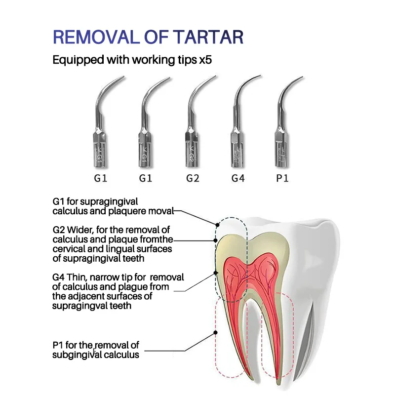 VRN-K08B ultrasonic scaler is used to remove dental stains on the surface of oral teeth and tartar plaque in periodontal pockets