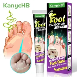 네일 Foot Care Tools KanyeHB Foot Ointment Feet Odor Care Cream Feet Skin Topical Cream Masajeador De Pies علاج الاسترخاء