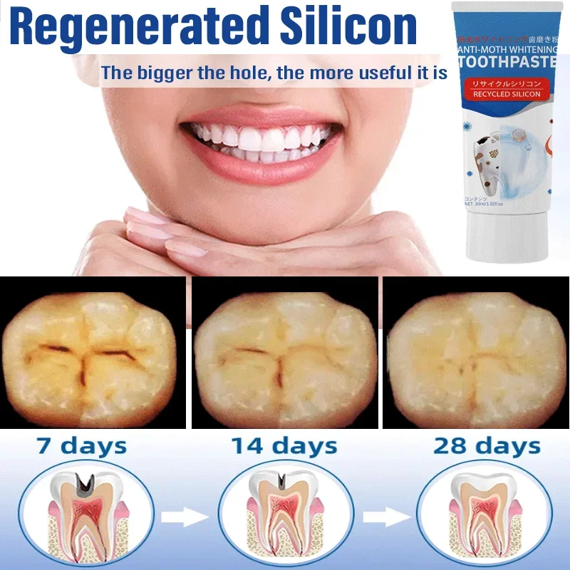 Blanchiment des dents efficace pour éliminer les cavités, plaque de calcul, parodontite