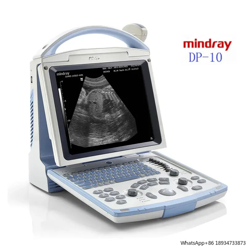 Mindray DP-10 Ultrasound Full Digital Ultrasonic Diagnostic Imaging System B/W Portable Ultrasound Machine