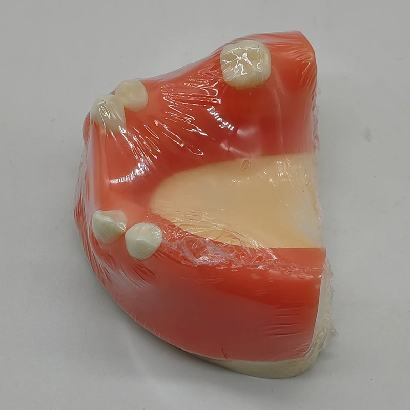 High Quality M2004 Implant Practice Model Dental Teeth Standard Model for Student Study