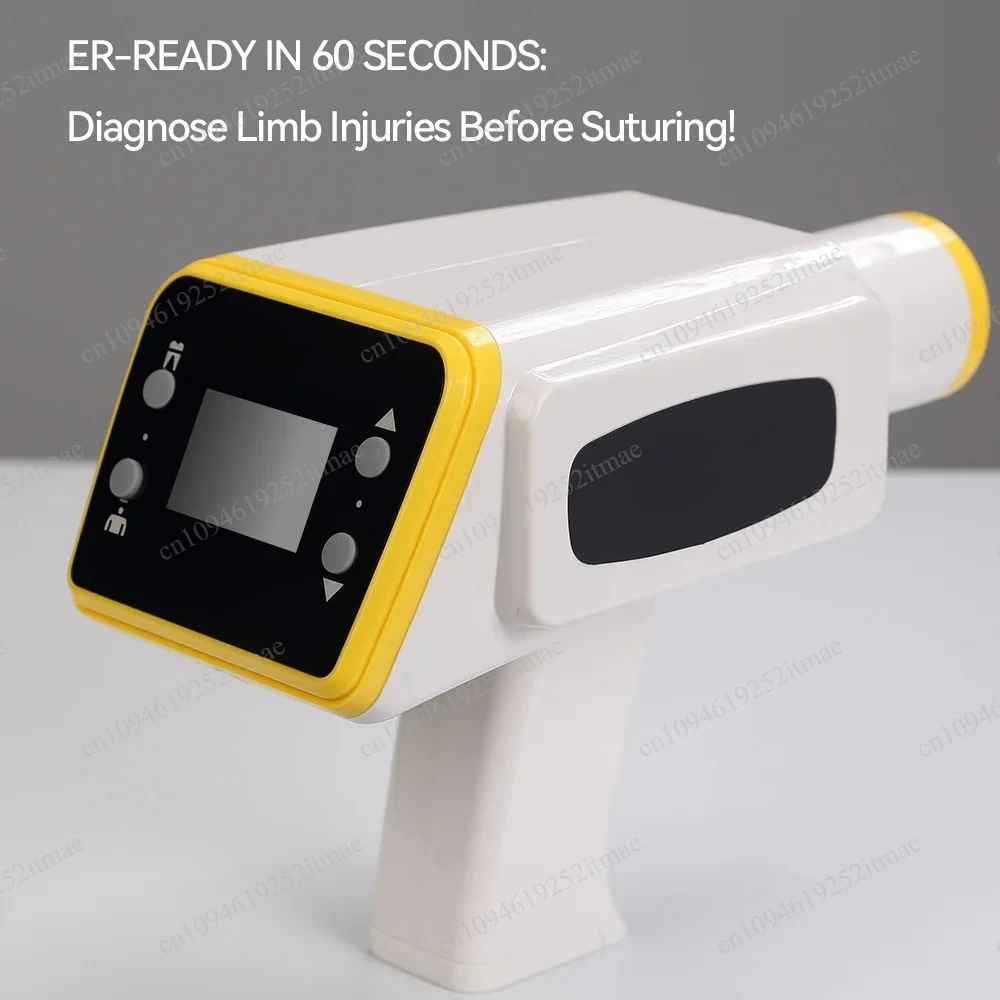 Handheld Veterinary X-Ray Unit Battery Operated Digital Radiography for Pet Hospital Farm