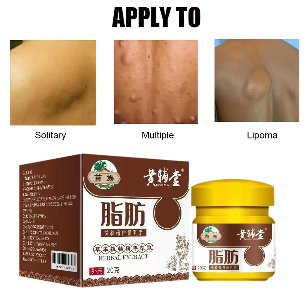 20g Lipoma Remover Treatment Cream Fat Mass Herbal Medicine Plaster Lumps Fibroma Multiple Lipomas Cellulite Body Health Care