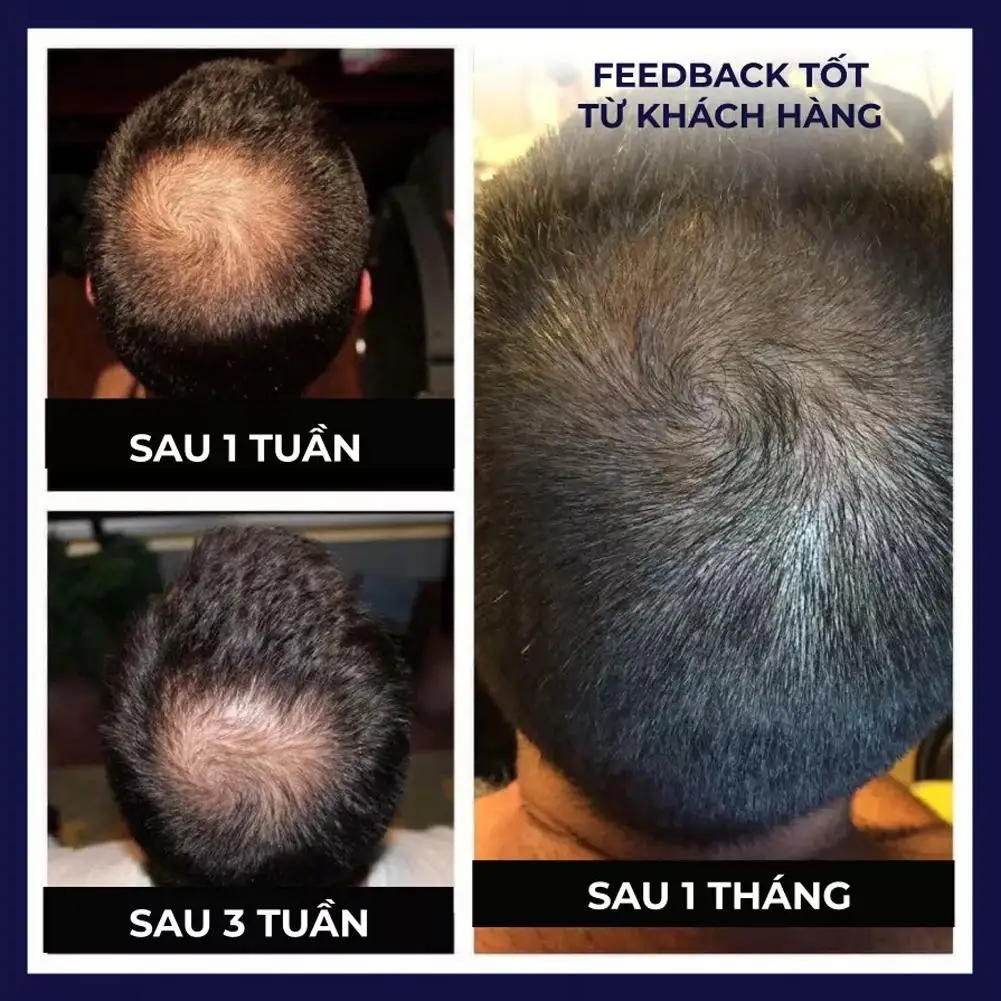 BAWA rumah rambut sehat dengan FEG organik perawatan rambut minyak Spary untuk rambut panjang lebih tebal-50ML