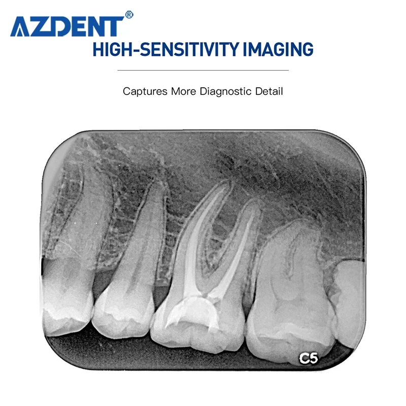 Hot Sale Imaging Plate Phosphor Digital X-ray Plate X Ray Price