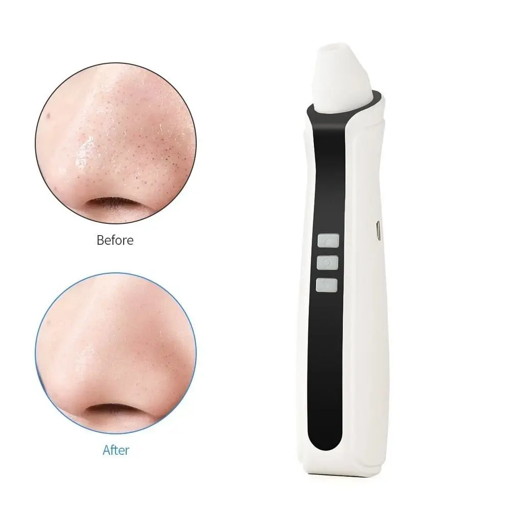 Blackhead Remover Vacuum with 20X Monitoring Camera 3 Suction Modes Facial Deep Cleansing Acne Removal Shrink Pores