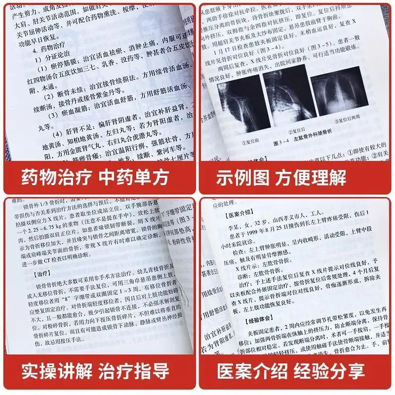 伝統的な中国の薬の骨設定療法骨のグラフィック図設定操作骨傷害治療ブック