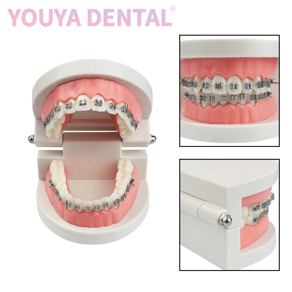 1pc 28-Teeth Standard Tooth Model Orthodontic Tooth Model With Metal Self-Ligating Brackets Ceramic Bracket Teaching Tooth Model