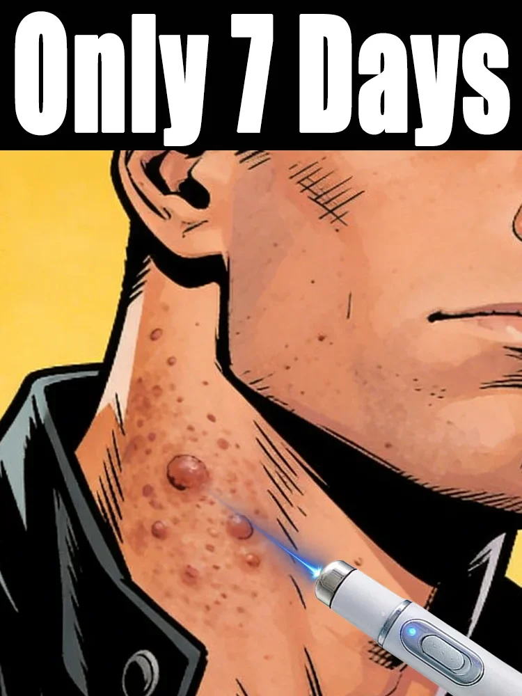 

Лазерная ручка для удаления бородавок без опасности ожогов и разжигания воспалений