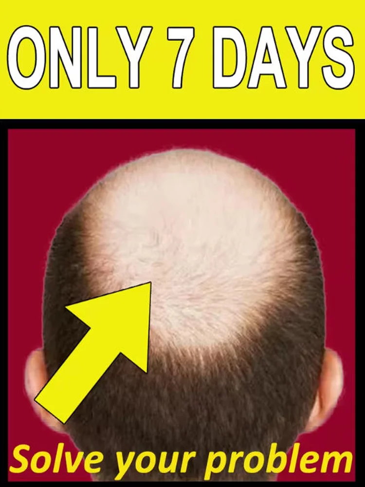 

98% of buyers buy again, have more and more hair, say goodbye to baldness, thick hair,Hot selling product