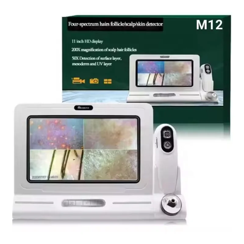 Professional Trichoscopy Scalp Hair Analyzer, High Definition Skin and Hair Camera, Diagnostic Tool